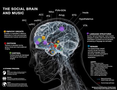 What Does It Mean When You Hear Music in Your Head? An Examination of Inner Soundscapes